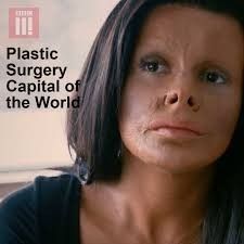 Watch Full Movie :Plastic Surgery Capital of the World (2018)