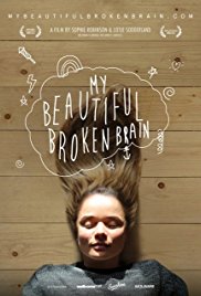 Watch Free My Beautiful Broken Brain (2014)
